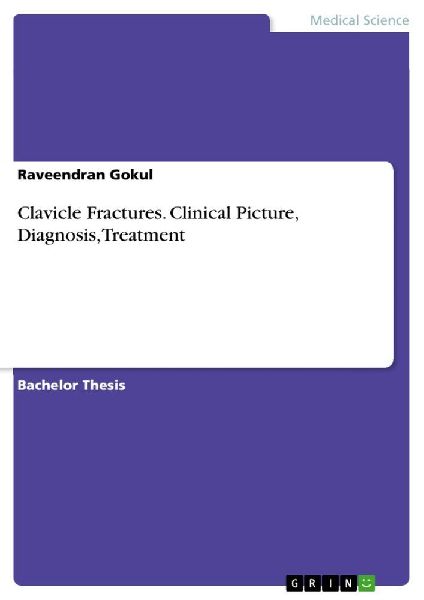 Clavicle Fractures. Clinical Picture, Diagnosis, Treatment