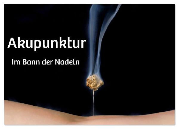 Akupunktur - Im Bann der Nadeln (Wandkalender 2026 DIN A3 quer), CALVENDO Monatskalender